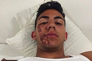 Incidente in scooter per Bastianini, ma a Brno correrà