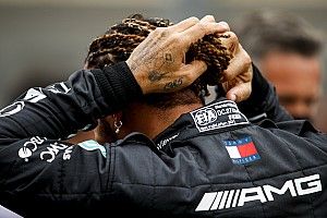 Hamilton: Valószínűleg el kell majd látogatnom egy specialistához