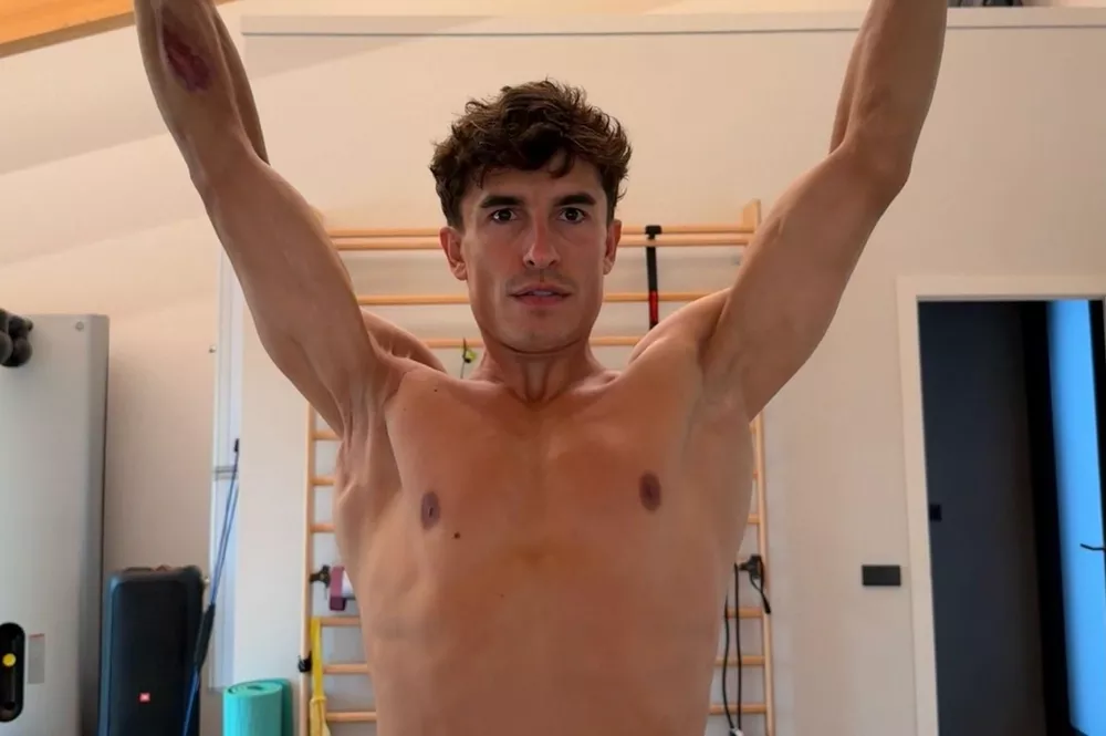 Marc Marquez d&eacute;voile les s&eacute;quelles sur son &eacute;paule dans un post sur les r&eacute;seaux sociaux