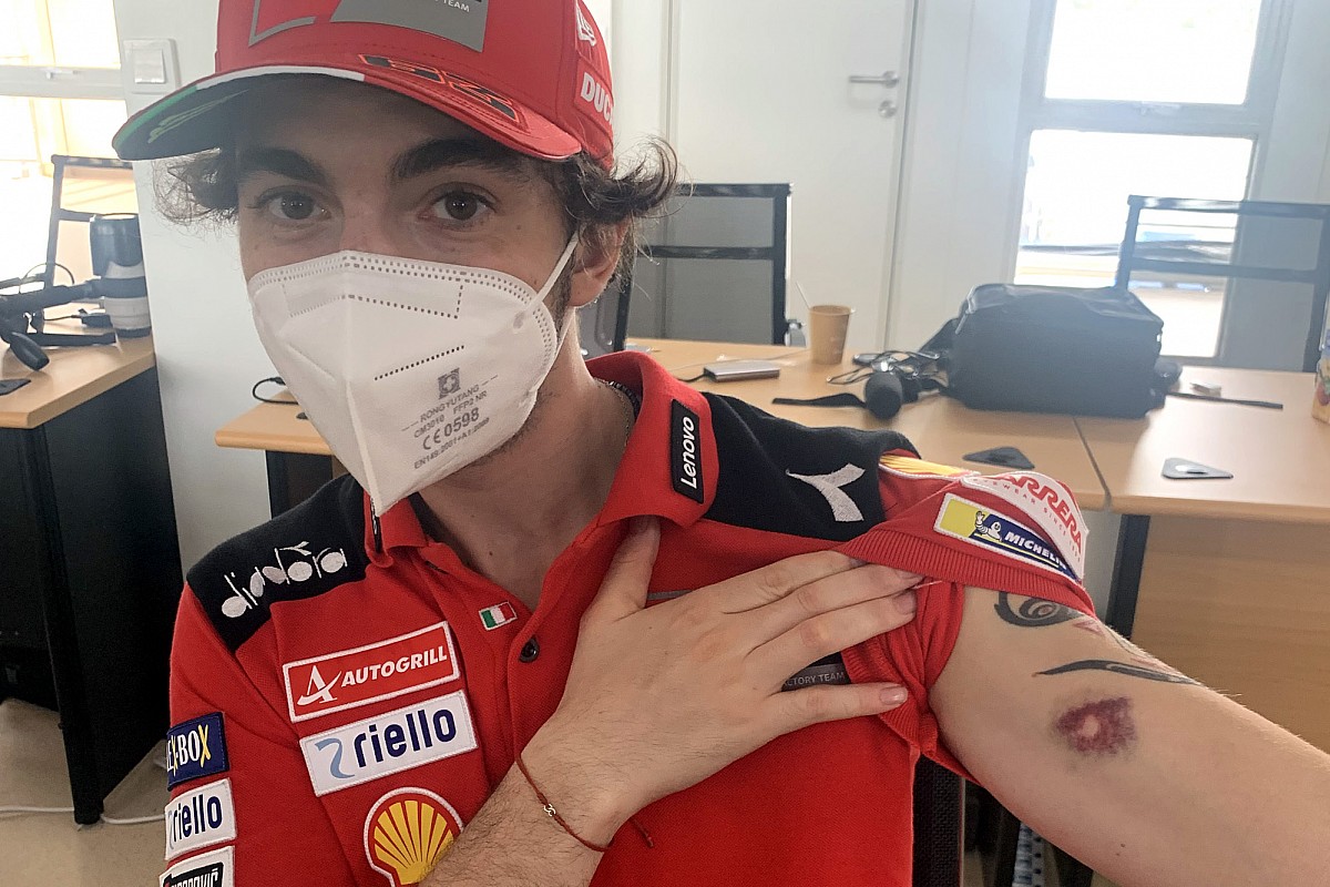 MotoGP | Bagnaia, che livido sul braccio: "I sassi sono proiettili"