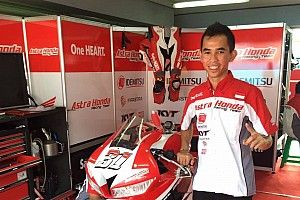 Gerry Salim cedera patah tulang jari tangan
