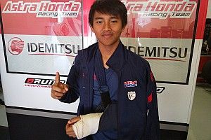 Mario SA cedera patah pergelangan tangan