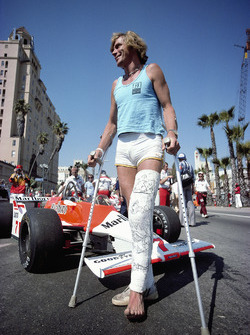 James Hunt gipszben a síbalesetét követően