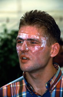 Jos Verstappen, Benetton, pit stop yangını sonrası yaralı