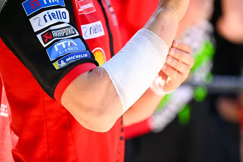 Le bras de Marc Marquez, Ducati Team