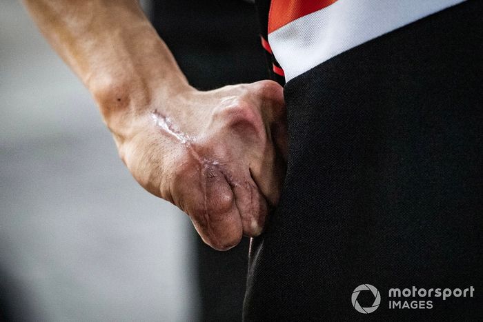 Detalle de la mano de Takaaki Nakagami, Equipo LCR Honda