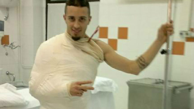 Dovizioso si frattura la clavicola in motocross